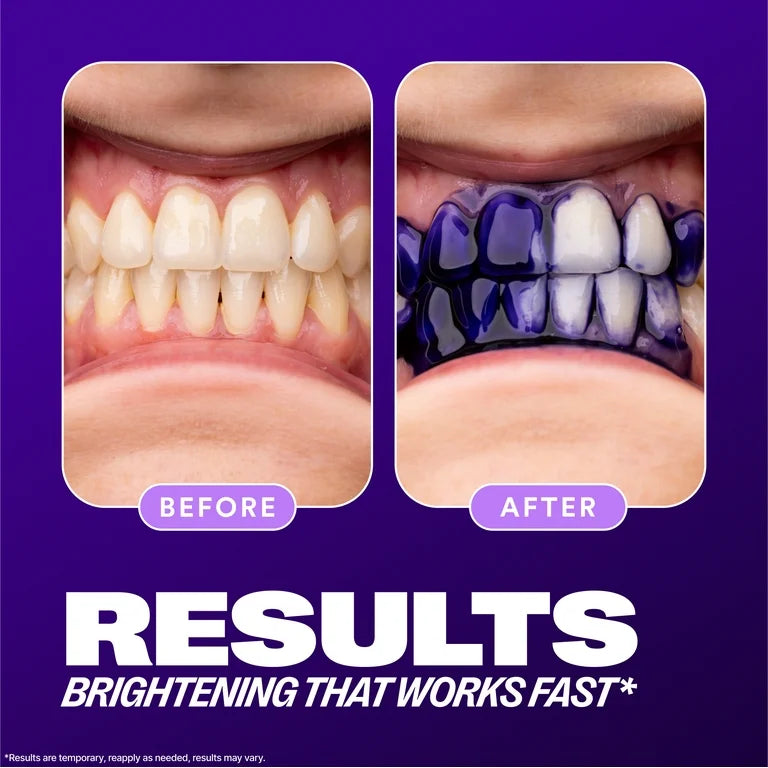 V34 Colour Corrector Serum โ Teeth Brightening (30ml)