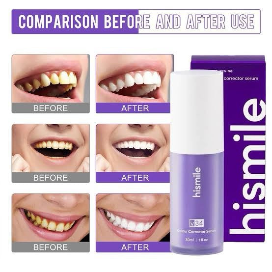 V34 Colour Corrector Serum – Teeth Brightening (30ml)