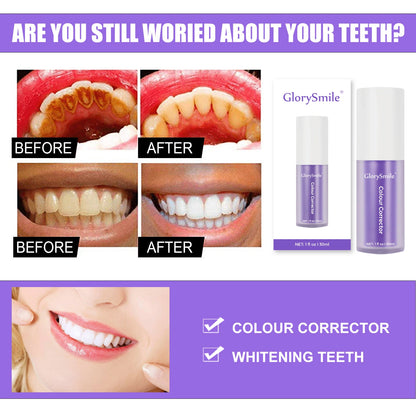 V34 Colour Corrector Serum – Teeth Brightening (30ml)