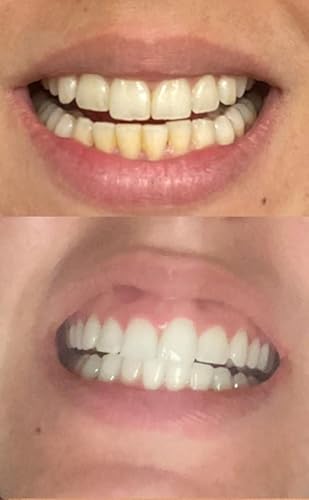 Image from reviewer Rasha